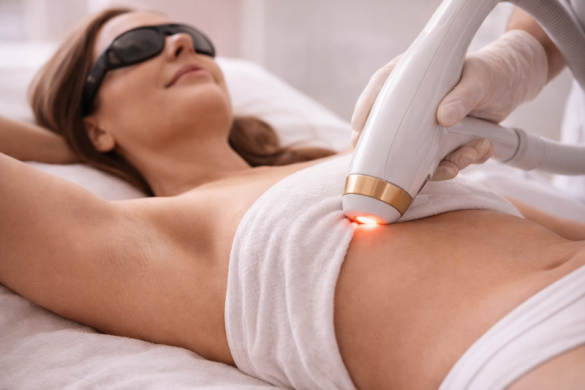 Epilation laser Cabriès